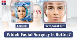 Facelift Istanbul Options and Facial Rejuvenation Choices